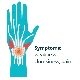 hand showing tendons, and muscles in the wrist with swelling